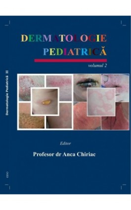 Dermatologie Pediatrică. Volumul II - Anca Chiriac - Ebook - 978-83-963773-4-0