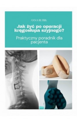 Jak żyć po operacji kręgosłupa szyjnego? Praktyczny poradnik dla pacjenta - Anna Rubik - Ebook - 978-83-973014-0-5