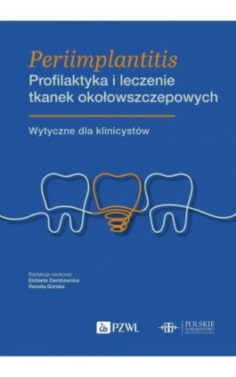 Periimplantitis Profilaktyka i leczenie tkanek okołowszczepowych - Ebook - 978-83-01-23999-2