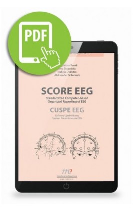 SCORE EEG Standardized Computer-based Organized Reporting of EEG. CUSPE EEG Cyfrowy Ujednolicony System Prezentowania EEG - Magdalena Bosak - Ebook - 978-83-66892-29-3